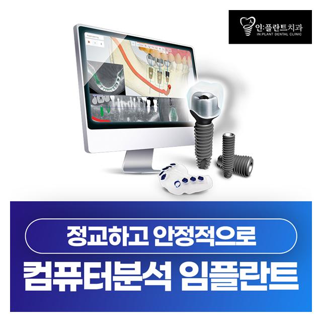컴퓨터분석 임플란트 더 정교하고 안정적으로 진료합니다